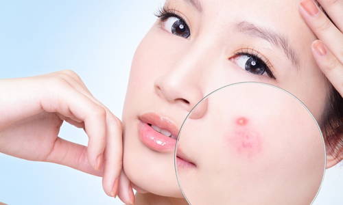 TOP 2 SỮA RỬA MẶT CHO DA MỤN NHẠY CẢM ĐƯỢC ƯA CHUỘNG TẠI THỊ TRƯỜNG NHẬT BẢN