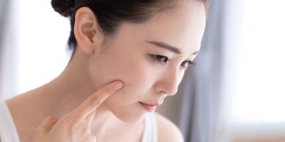 BỎ TÚI CÁCH TRỊ MỤN HIỆU QUẢ TẠI NHÀ ĐỂ CÓ LÀN DA MỘC ĐÁNG MƠ ƯỚC