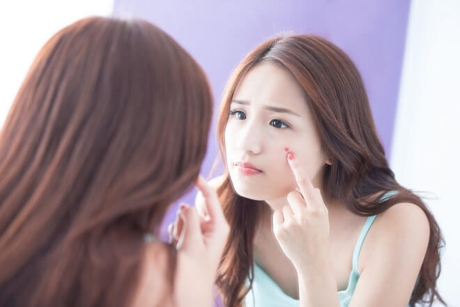 CHĂM SÓC DA MẶT TUỔI DẬY THÌ NHƯ THẾ NÀO ĐỂ CÓ LÀN DA KHỎE ĐẸP HƠN